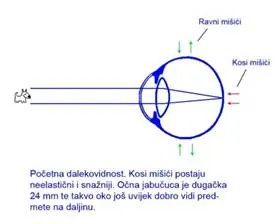 Slika br. 10