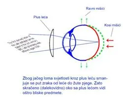 Slika br. 10