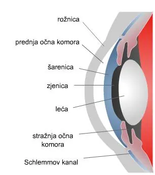 Povišeni očni tlak ili glaukom – ilustracija 1