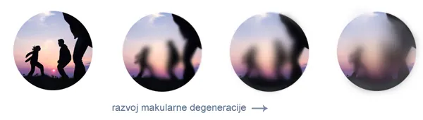 Slika 1. Takvi ljudi više ne mogu normalno funkcionirati