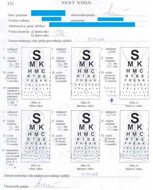 Slika 2 Na slici 2 vidimo da je pacijentica imala na desnom oku -1